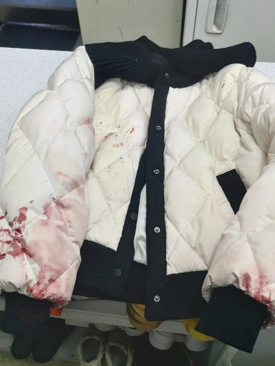 施工前：シミ・黄変のある白ジャケット